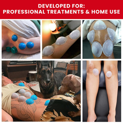 Lure Essentials Cupping Therapy Set 10 Professional Silicone Cupping Cups for Muscle Knots, Joints, Muscles, Arms and Feet Lure EssentialsBuy Supplements Australia
