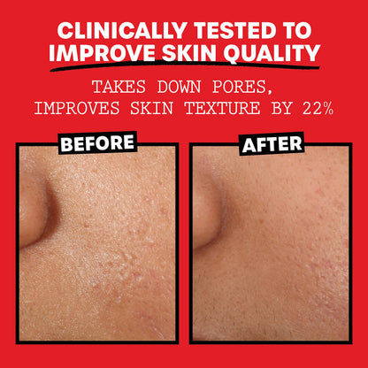 Thayers Alcohol-Free, Hydrating Rose Petal Witch Hazel Facial Toner 12 oz + 3oz THAYERSBuy Supplements Australia