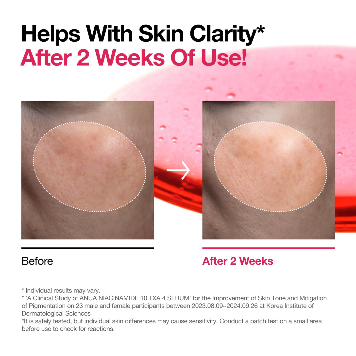 Anua Niacinamide 10 + TXA 4 Serum, Dark Spot Care, Hyaluronic Acid, Tranexamic Acid - Maple Wellness Supplements