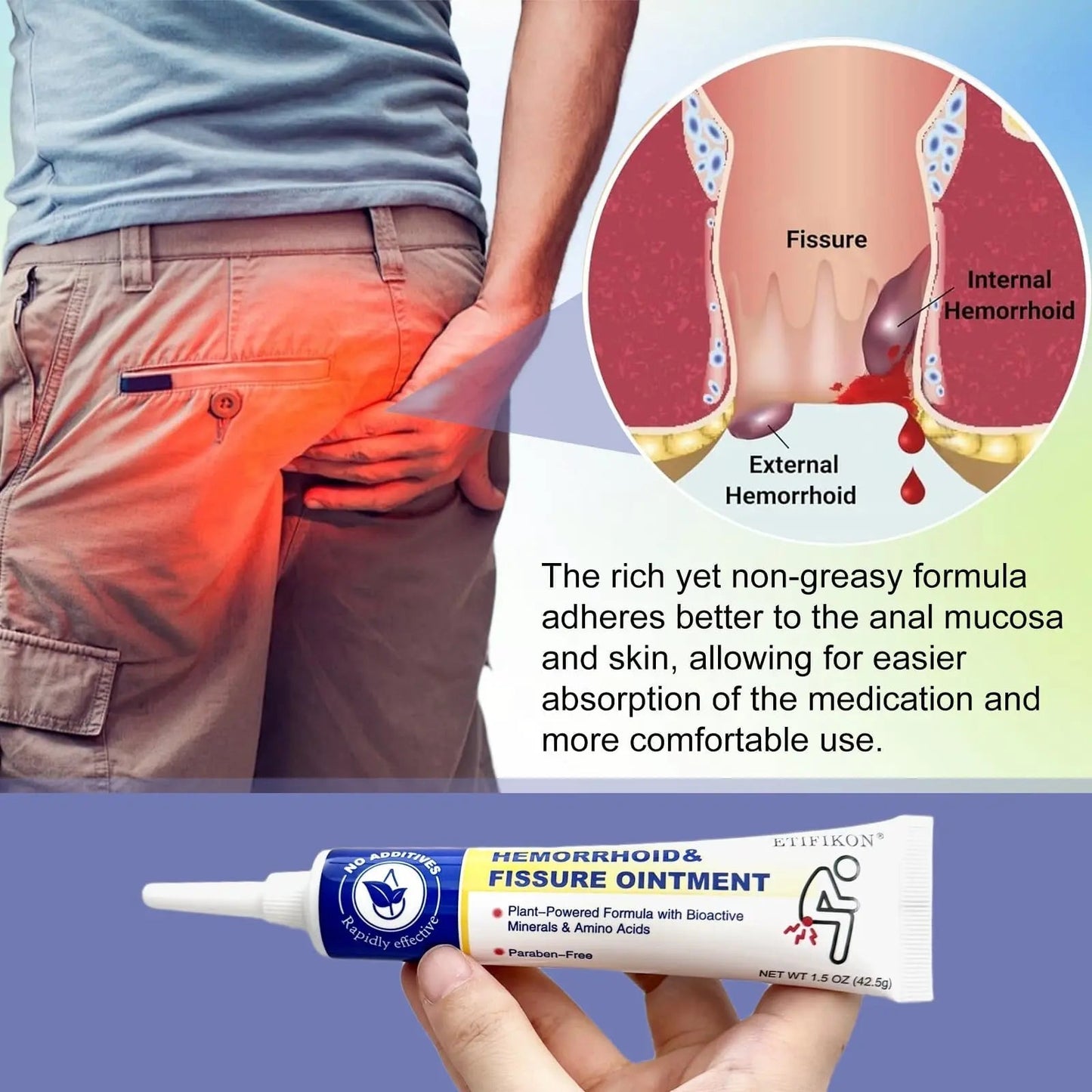 ETIFIKON Hemorrhoid & Fissure Ointment with 4% Lidocaine & Phenylephrine HCI – 42.5g Comforting Care Cream for Internal & External Areas – Helps Soothe Irritation & Support Daily Comfort (1 Pack) - Maple Wellness Supplements