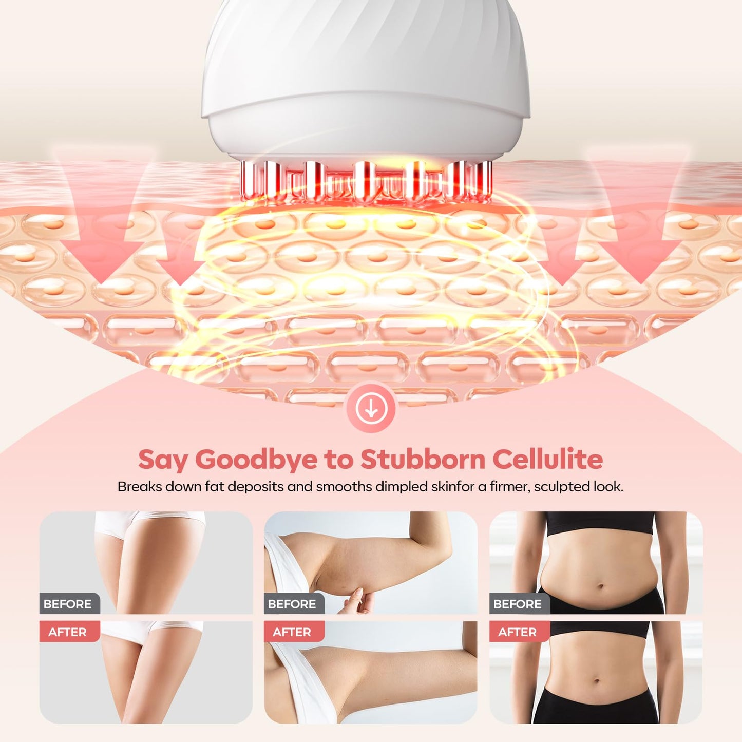 HarrFlow Lymphatic Drainage Massager & Anti Cellulite Massage Tool, Lymphatic Massager,Helps Reduce Stretch Marks & Cellulite，for Belly, Arms & Legs,Body Sculpting Machine with Heat & Vibration - Maple Wellness Supplements