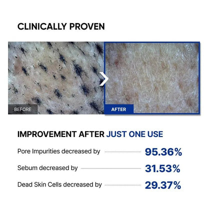 SAYNID MICROBIOME RENEWING CREAM MASK TRIAL KIT, Wash-off Cream, Soft Exfoliating Face Scrub Dead Skin Cells | 4.5g/0.15oz (3EA) - Maple Wellness Supplements