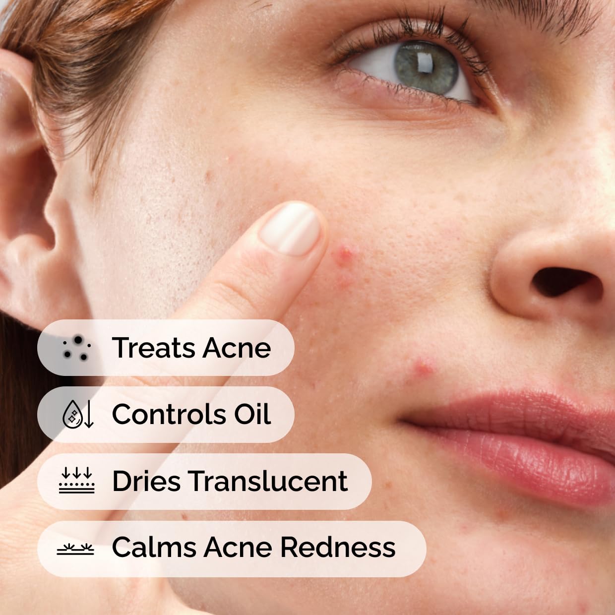 The Ordinary Sulfur 10% Powder-to-Cream Acne Spot Treatment Concentrate, Reduces Pimple Size and Zit Redness, 0.18 Oz - Maple Wellness Supplements