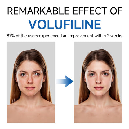 Volufiline Serum, Volufiline Under Eye Serum, Cosmetic Grade Ampoule for Skin Elasticity Improvement, Face & Body Fine Lines, Hydrating Texture, 10ml*2 - Maple Wellness Supplements