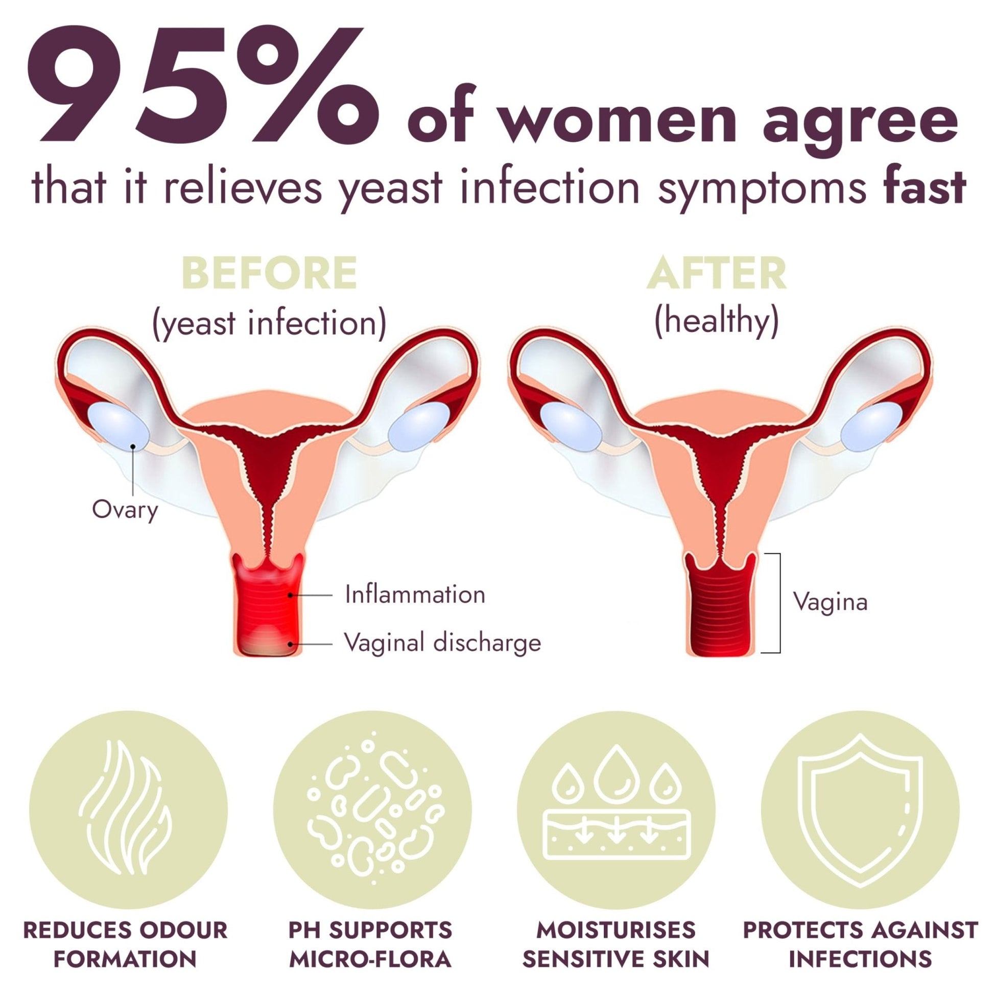 Yeast Infection Treatment for Women | Boric Acid Suppositories For Women | Helps Relieve Itching & Irritation | Vaginal Aid for Inflammation, Dryness & Watery Discharge | 12 Vaginal Suppositories - Maple Wellness Supplements